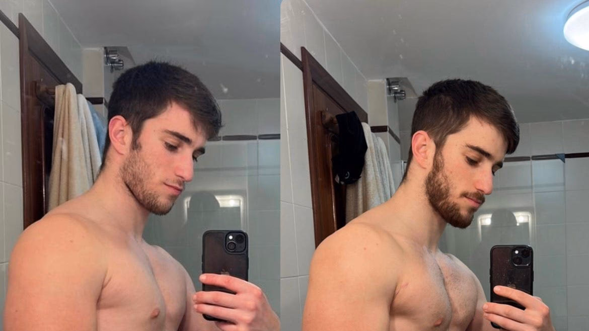 ¿Qué pasó con Álvaro Lorenzo?