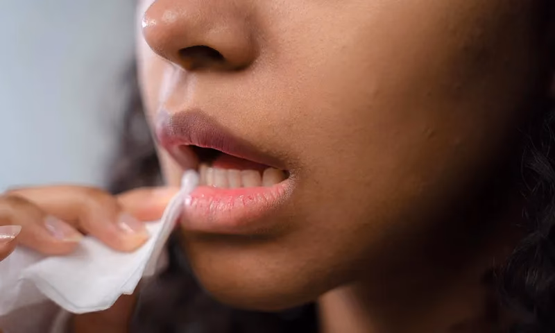 ¿Qué hacer si hay indicios de boca seca?