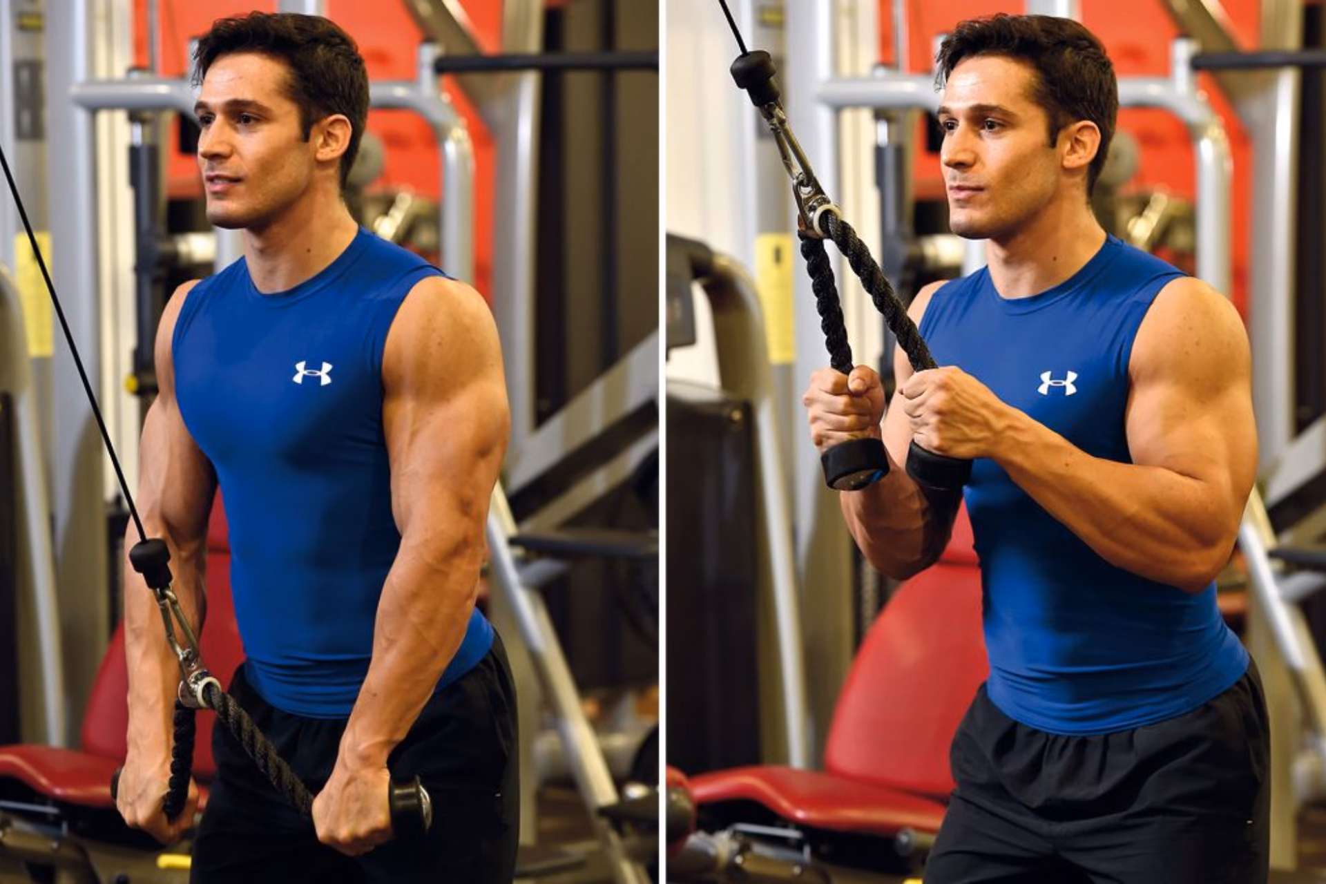 ¿Qué es el vasto externo?