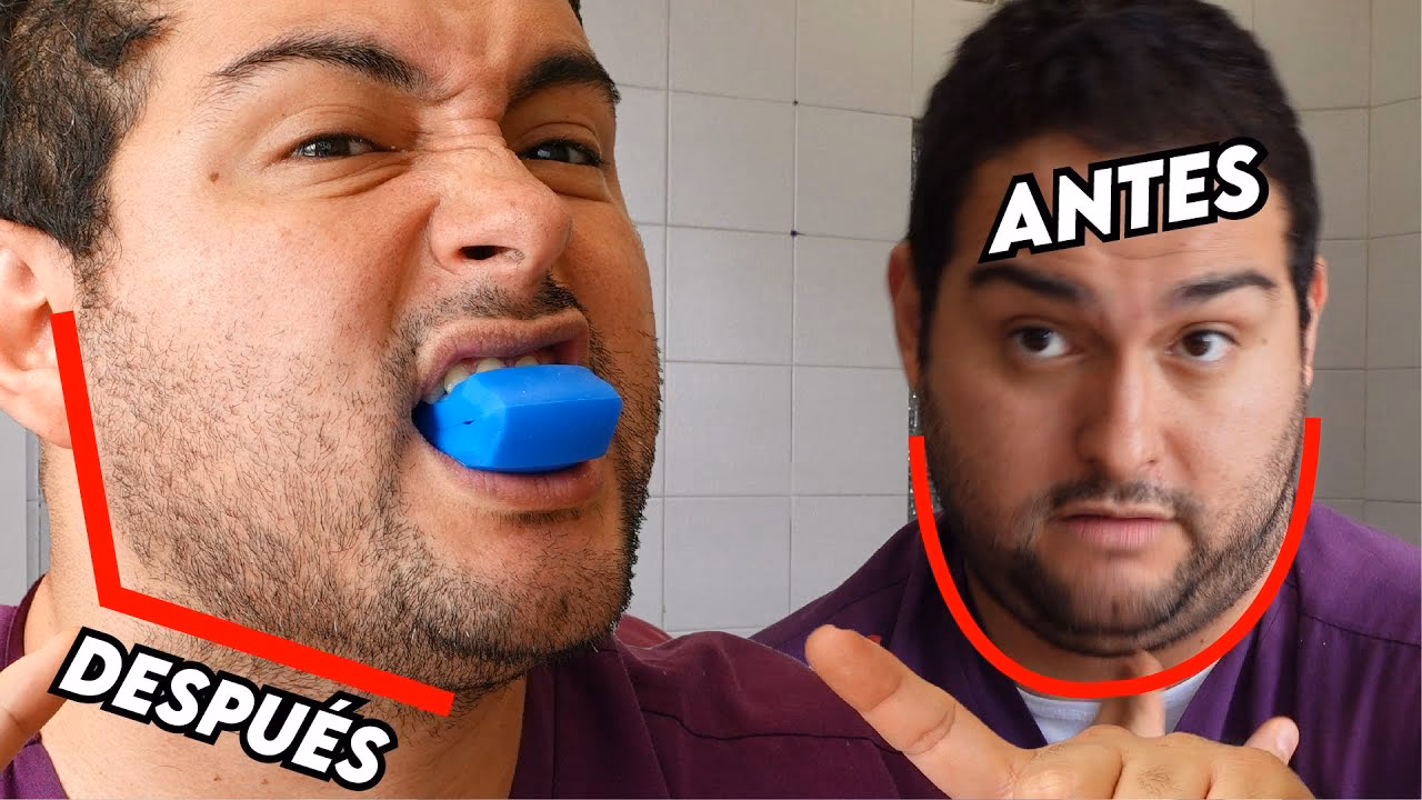 ¿Qué es un ejercitador de mandíbula?