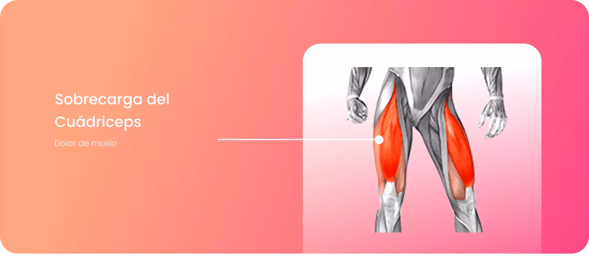 ¿Qué hacer con el dolor en cuádriceps?