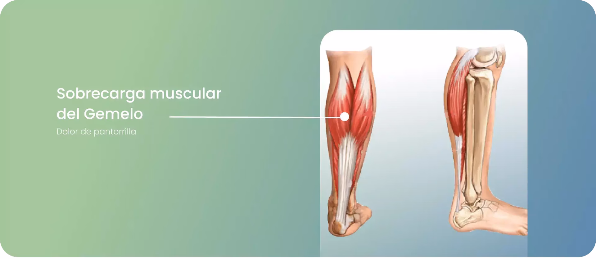 ¿Por qué tengo dolor en los gemelos tras una carrera intensa?