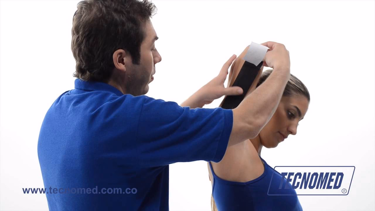 ¿Qué causa el desgarro del tendón del tríceps?