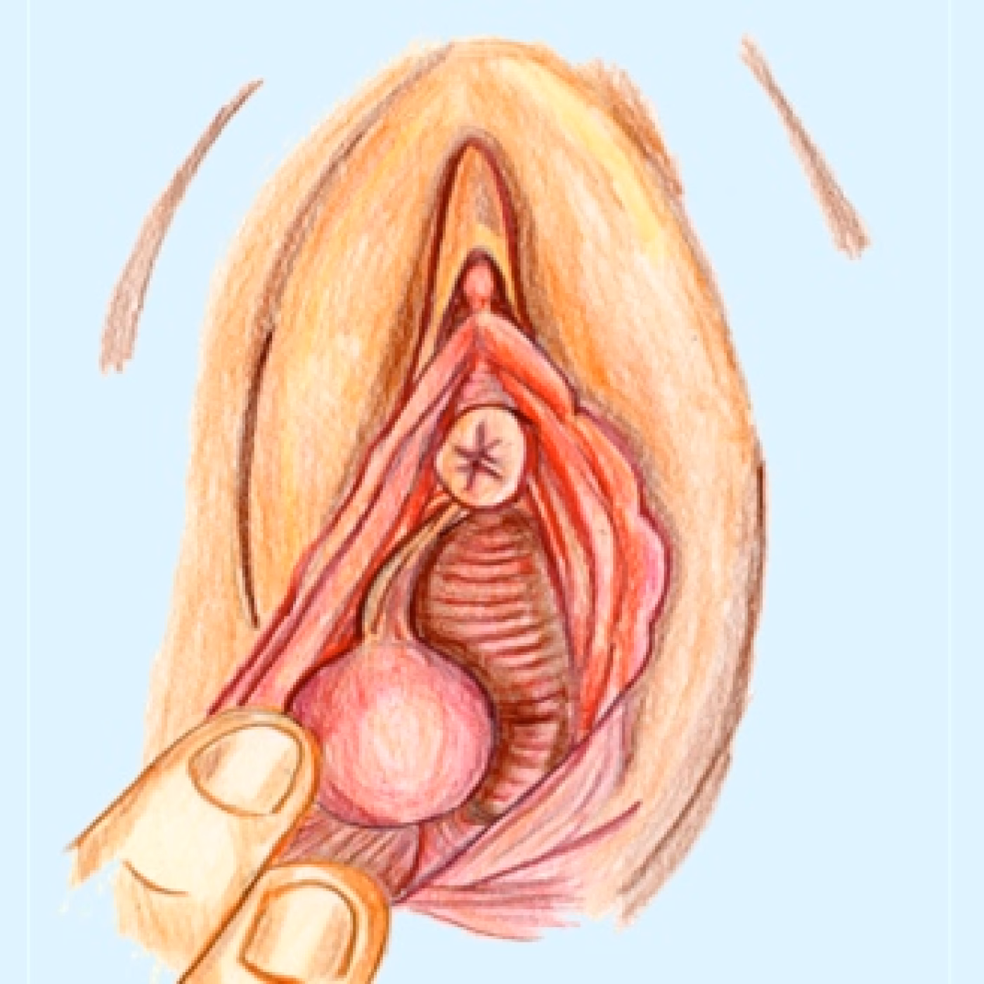 ¿Cómo se transmite la bartolinitis?