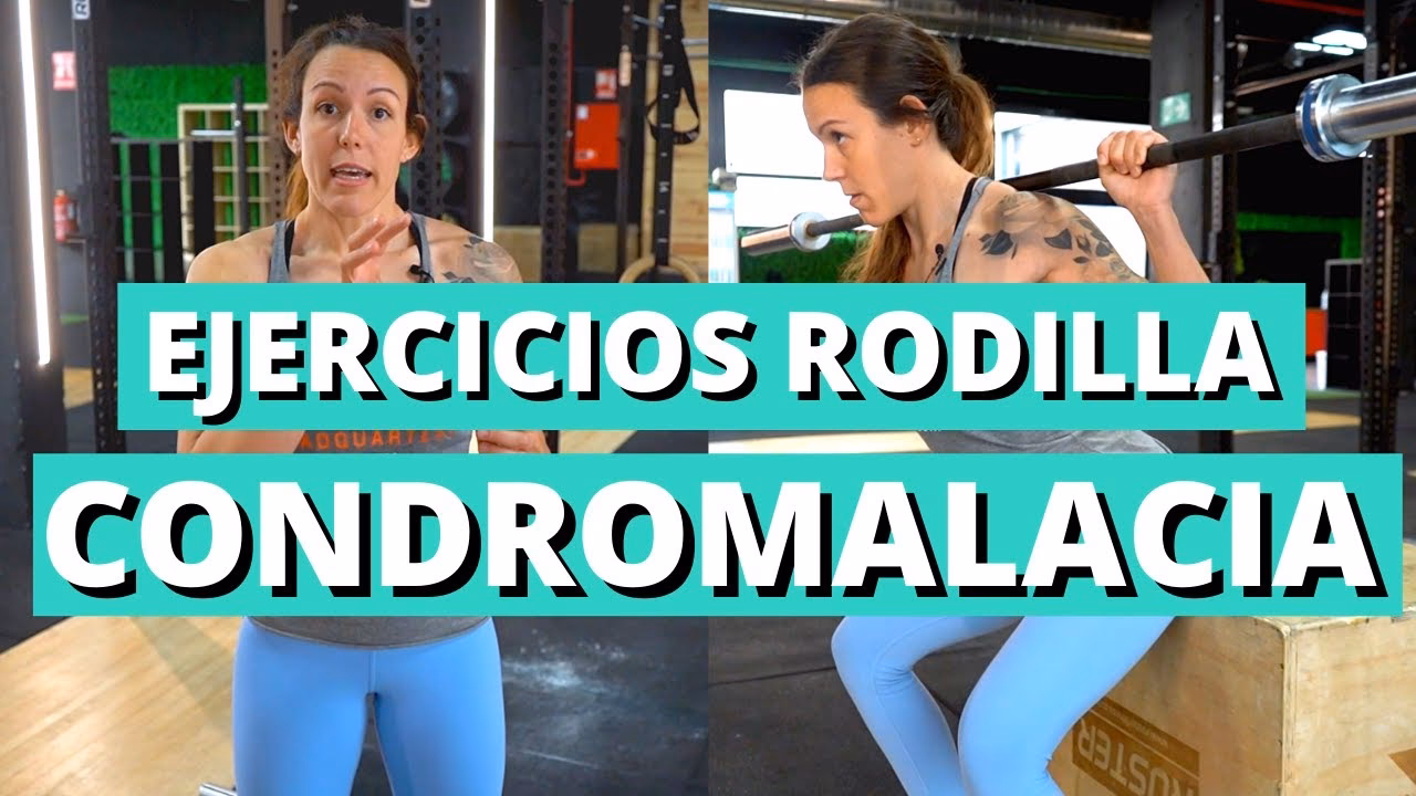 ¿Cómo hacer ejercicio para la condromalacia rotuliana?